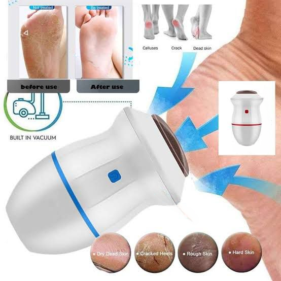 Find Back Electric Callus Remover – Rechargeable Portable Foot File Pedicure Tool with Replacement Head