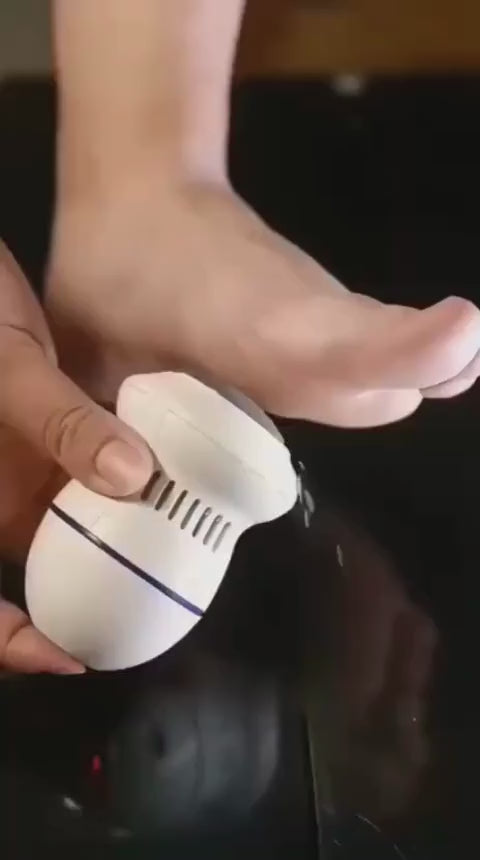 Find Back Electric Callus Remover – Rechargeable Portable Foot File Pedicure Tool with Replacement Head
